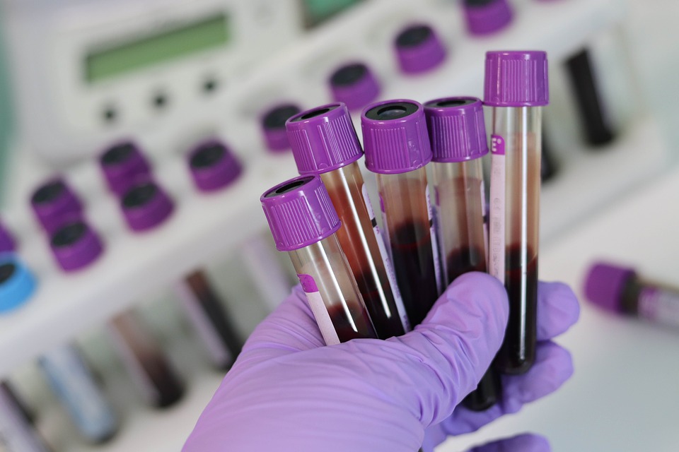 Algunhas probas de detección da COVID-19 requiren analítica de sangue